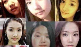 郑州整形失败爆料案件最新,揭秘美容行业潜规则与维权困境