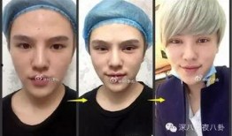 网红爆料明星整容视频,视频曝光惊人内幕